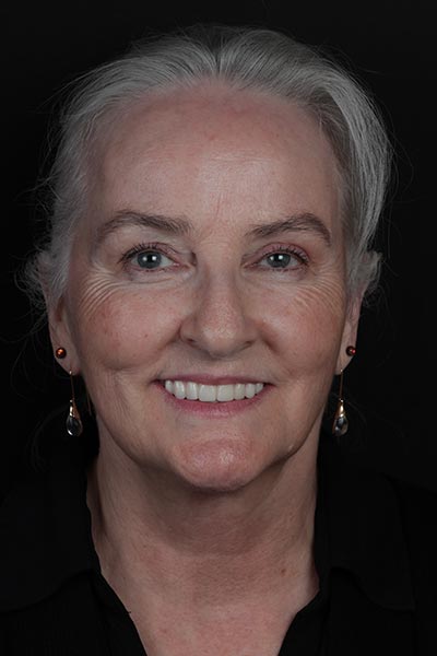 Denise Bjerke